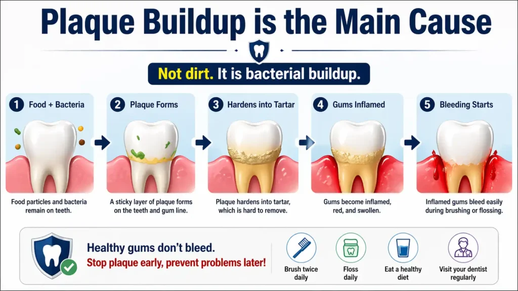 Plaque Buildup is the Main Cause